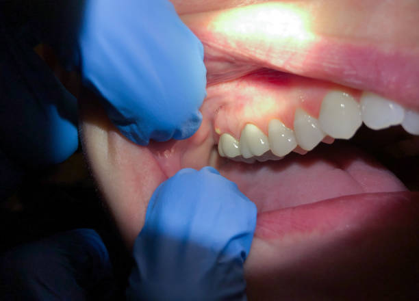 Best Broken or Cracked Tooth Emergency Dentist in Mineral Wells, TX