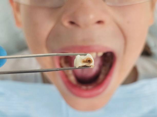 Best Weekend Emergency Dentist in Mineral Wells, TX